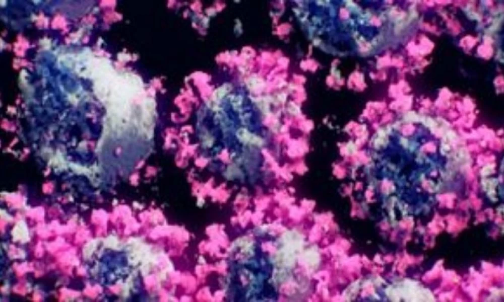 ECDC για κορονοϊό: Το φθινόπωρο ελλοχεύει κινδύνους-Αύξηση των κρουσμάτων και θανάτων σε χώρες με ανεπαρκή κάλυψη εμβολιασμού